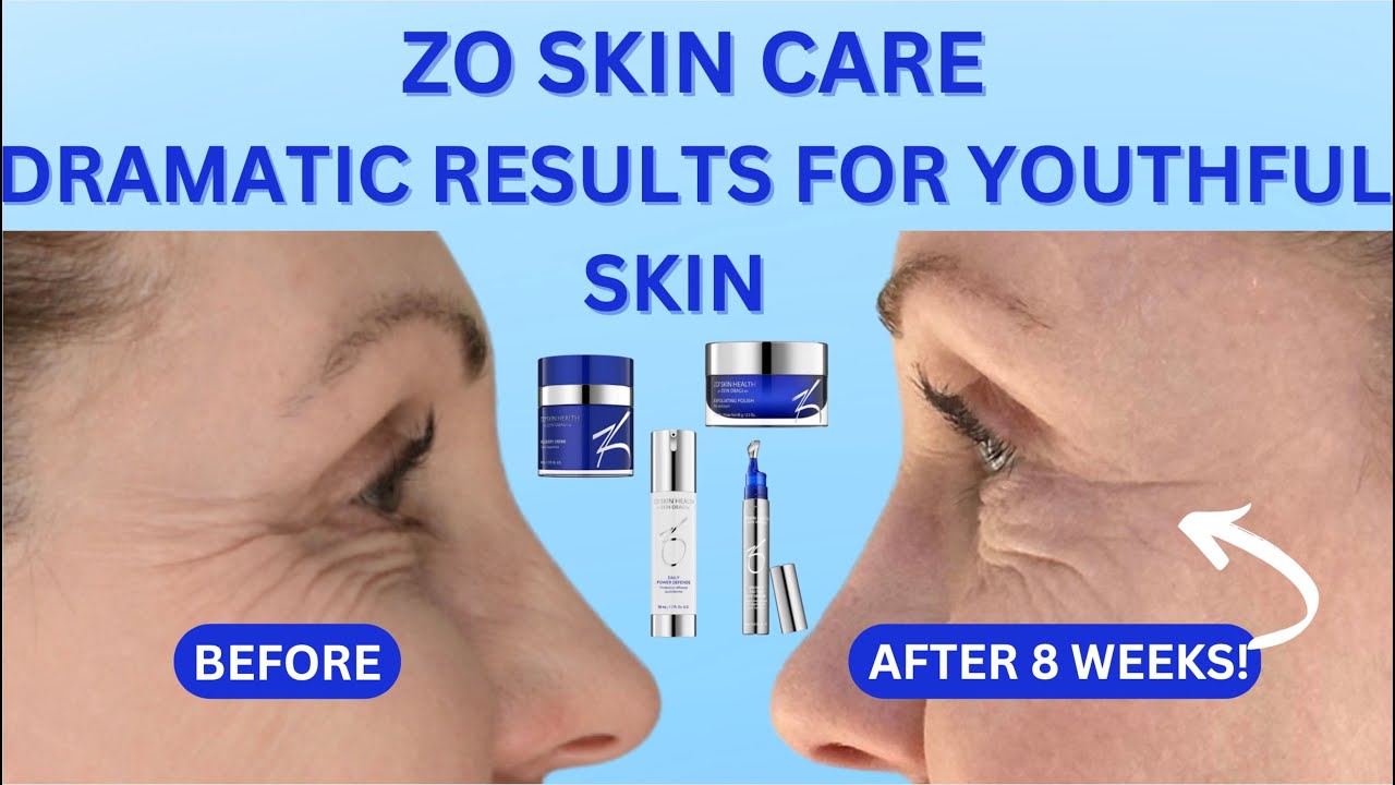 fine lines and wrinkles